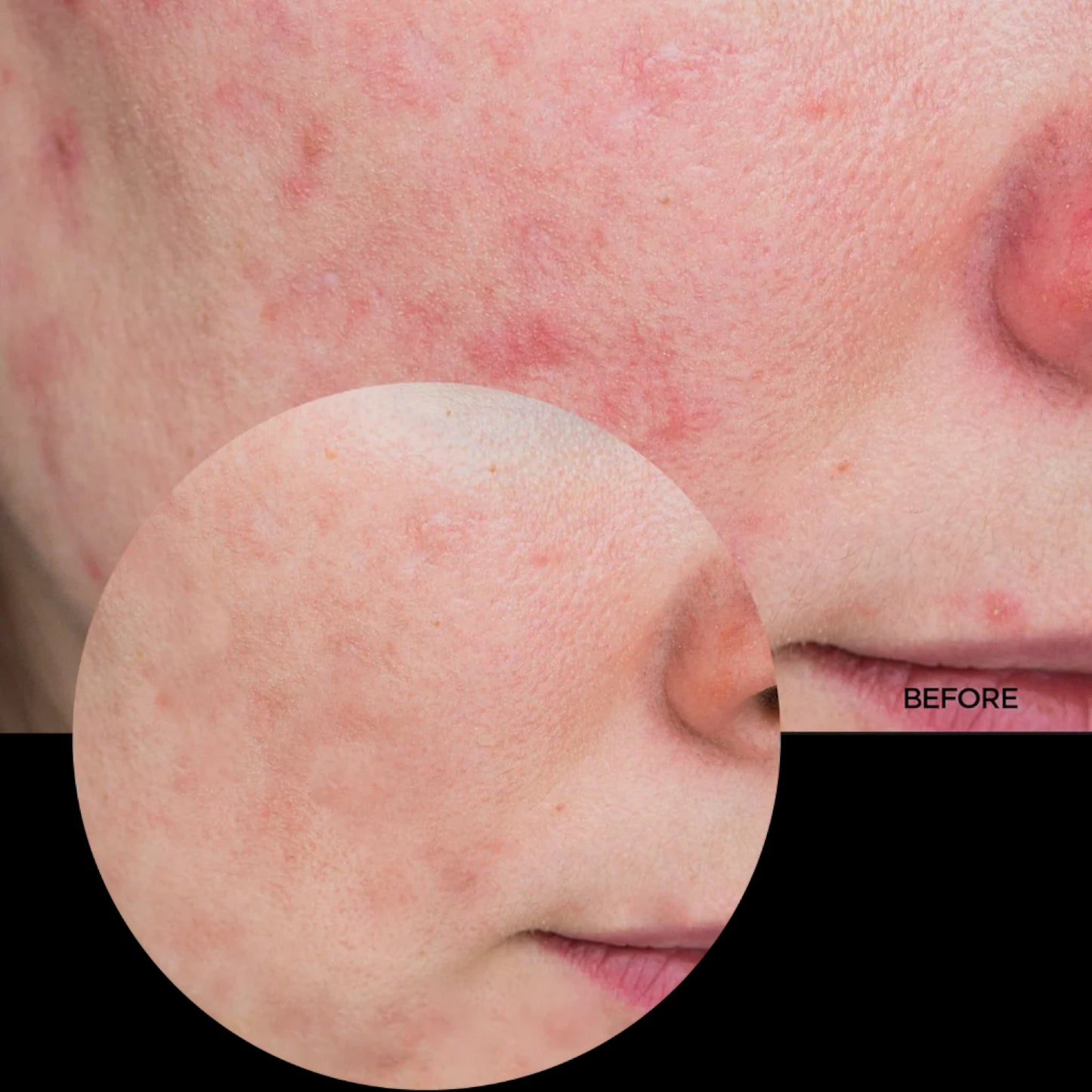 Revox Azelaic Acid Illuminating Solution – 30ml