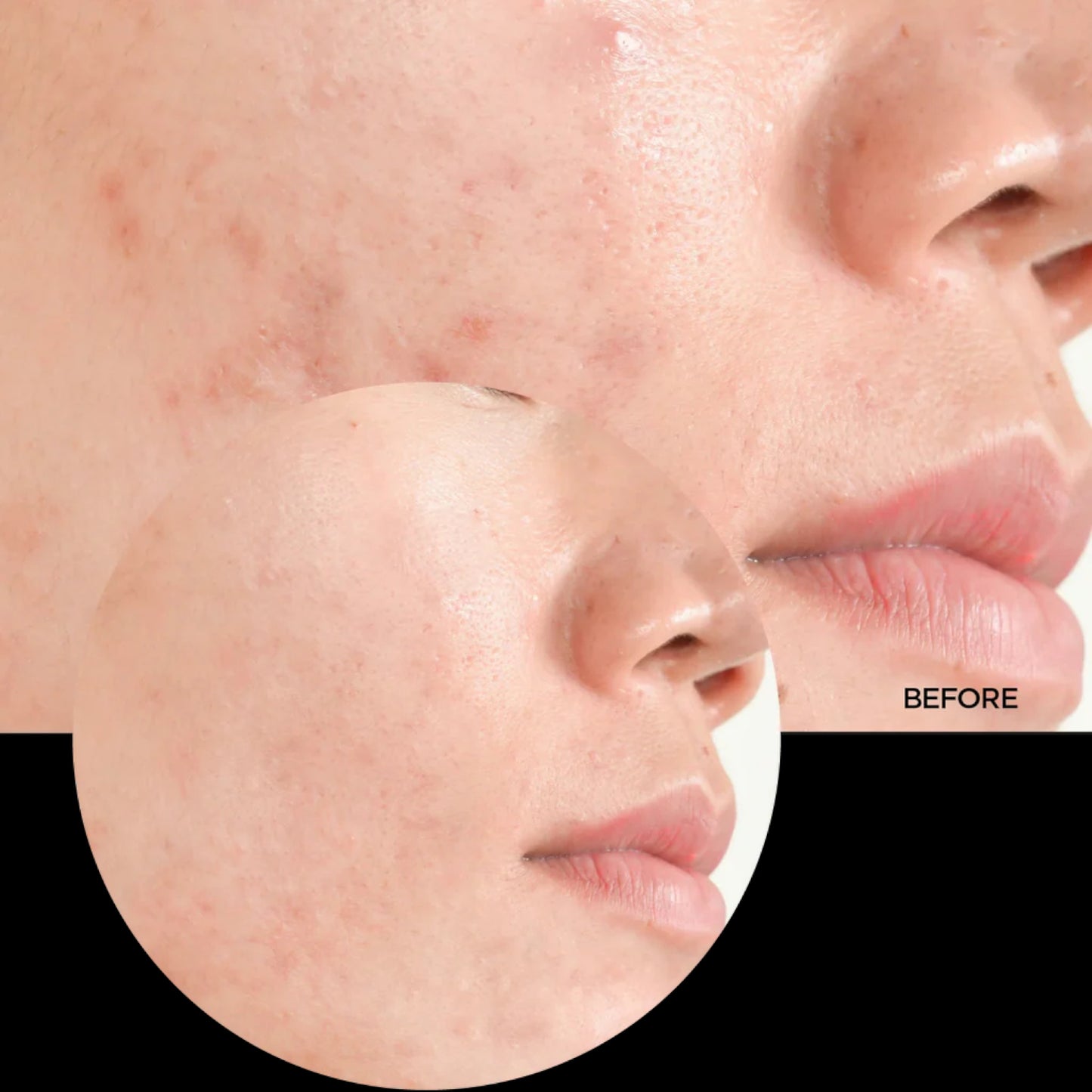 Revox Salicylic Acid Serum – 30ml