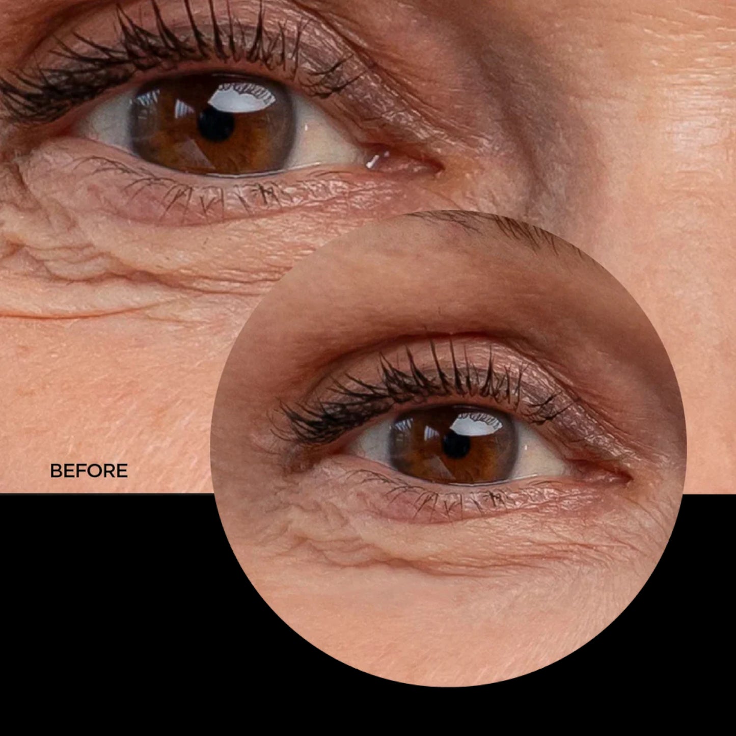 Revox Retinol Eye Gel Anti-Wrinkle – 30ml